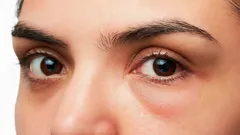 Wie du morgens Gesichtsschwellungen reduzierst – und warum sie entstehen: Stylist gibt Antwort